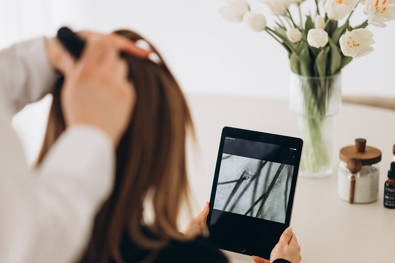 PREMIUM RESET bij Haarverlies